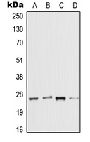 CPA2625-100ul - IL1F7 / FIL1Z