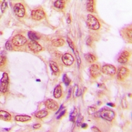 CPA2632-100ul - PRPF19 / NMP200