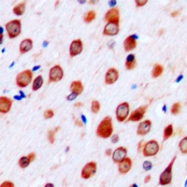 CPA2656-100ul - Neurotrimin