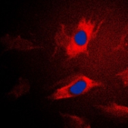 CPA2714-100ul - Isoleucyl-tRNA synthetase / IARS2