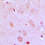 CPA2714-100ul - Isoleucyl-tRNA synthetase / IARS2