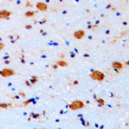 CPA2742-100ul - ARHGAP22