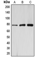CPA2742-100ul - ARHGAP22