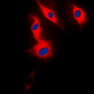 CPA2815-100ul - Acrosin-binding protein / ACRBP