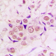 CPA2816-100ul - ZC3H8
