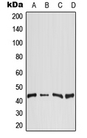 CPA2818-100ul - DGAT2