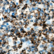 CPA2825-100ul - TNFRSF19L / RELT