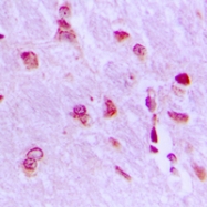 CPA2834-100ul - ARHGAP18