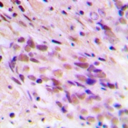 CPA2851-100ul - CDYL2