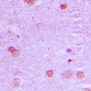 CPA2863-100ul - NCOA7