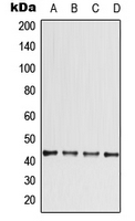 CPA2874-100ul - CCBE1