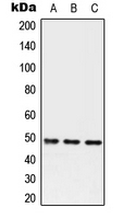 CPA2925-100ul - Alpha-1-antichymotrypsin / ACT