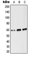 CPA2927-100ul - Angiopoietin-2