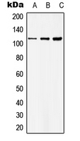 CPA2935-100ul - BNC1