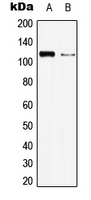 CPA2936-100ul - BMPR2