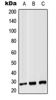 CPA2941-100ul - CD8 beta