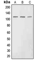 CPA2957-100ul - EPHA3