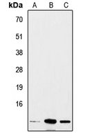 CPA2974-100ul - Insulin