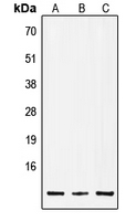 CPA2975-100ul - Insulin