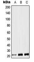 CPA2976-100ul - Leukemia inhibitory factor