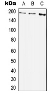 CPA2994-100ul - CD140b / PDGFRB