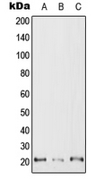 CPA3002-100ul - RAC2