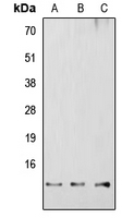 CPA3003-100ul - RBBP6 / RBQ1