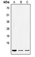 CPA3042-100ul - SEC61B
