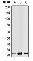CPA3062-100ul - RAB14