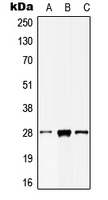 CPA3082-100ul - MOB2 / HCCA2