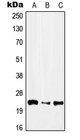 CPA3102-100ul - IFN alpha 1