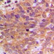 CPA3107-100ul - ABL1