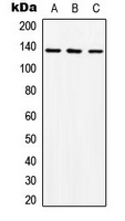 CPA3107-100ul - ABL1
