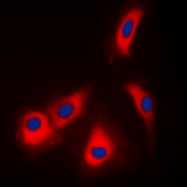 CPA3112-100ul - Adenosine kinase