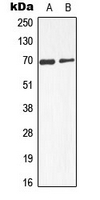 CPA3119-100ul - Alpha-fetoprotein / AFP