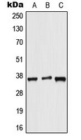 CPA3126-100ul - ALX3