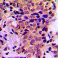CPA3139-100ul - ATF4