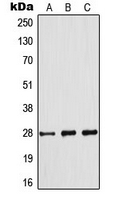 CPA3144-100ul - Bcl-2