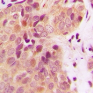 CPA3150-100ul - BRCA2 / FANCD1