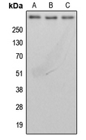 CPA3150-100ul - BRCA2 / FANCD1