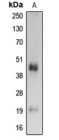 CPA3156-100ul - Caspase 4 p20