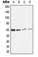 CPA3158-100ul - Catalase