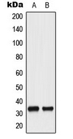 CPA3164-100ul - CDK1