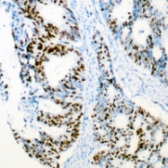 CPA3170-100ul - CDK2