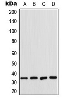 CPA3170-100ul - CDK2