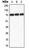 CPA3313-100ul - RPS6KB1 / STK14A