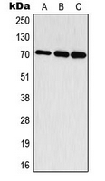 CPA3314-100ul - RPS6KB1 / STK14A