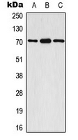 CPA3315-100ul - RPS6KB1 / STK14A