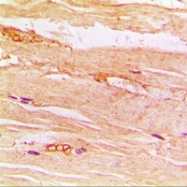 CPA3318-100ul - GLUT4 / SLC2A4