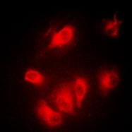 CPA3328-100ul - Aurora kinase A